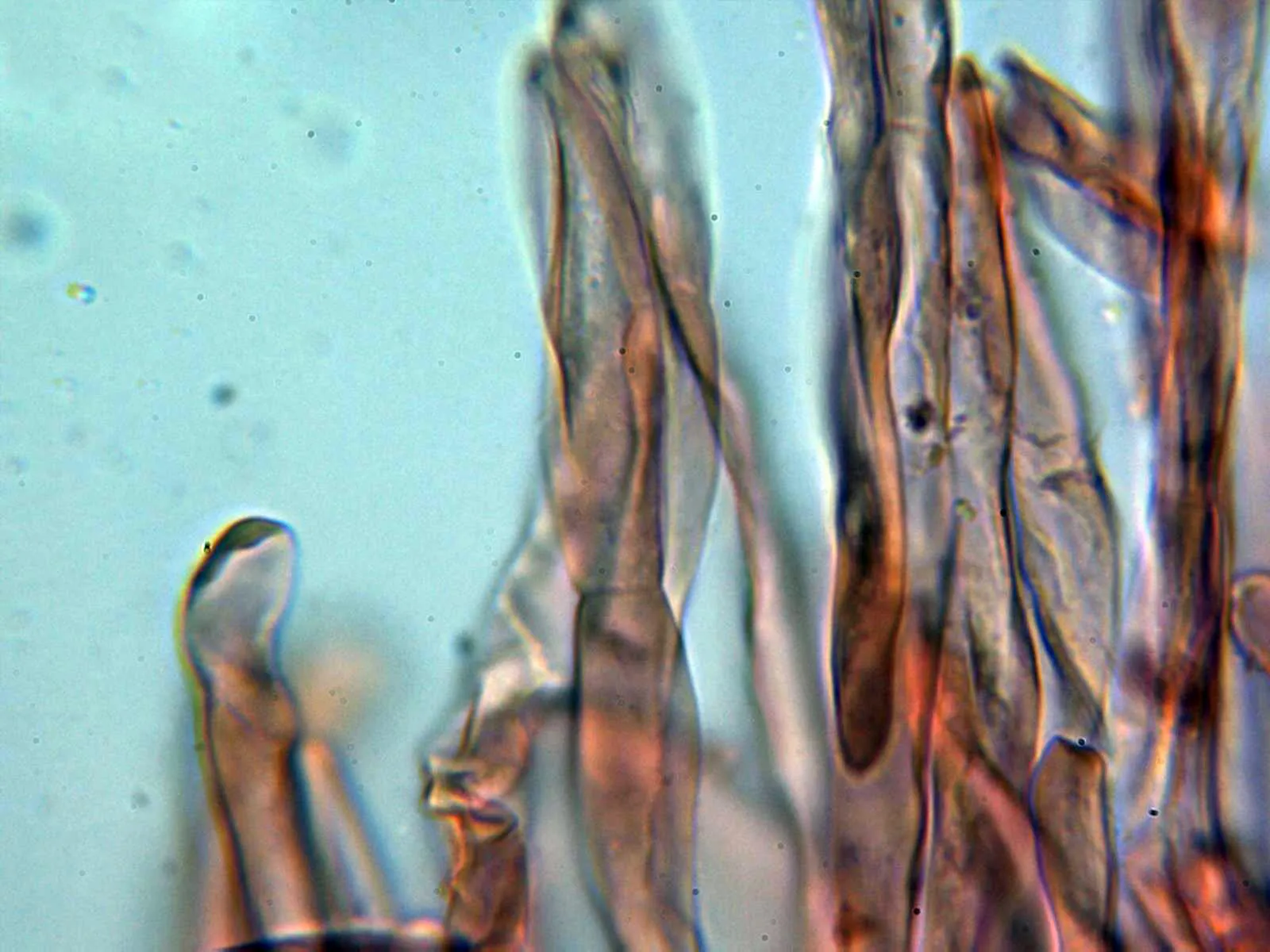 Microscopía de Macrolepiota excoriata - 10 - Hifas emergentes suprapellis